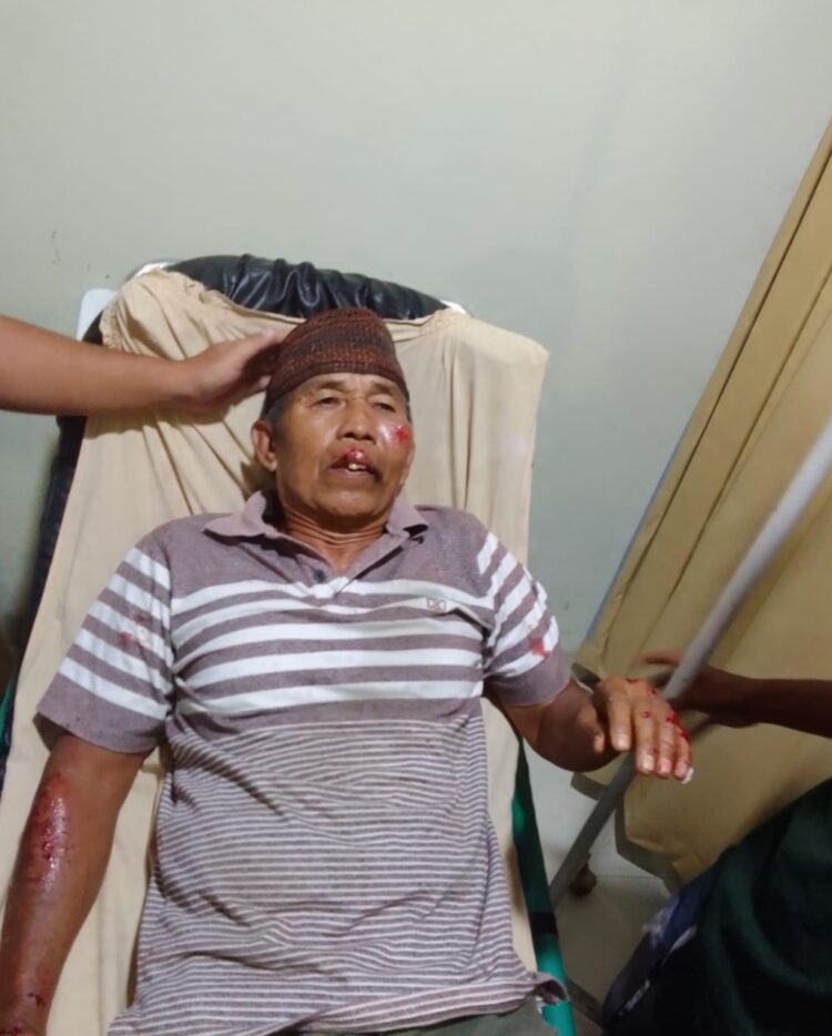Lubang Galian Jalan Di Jalan RPN Kotabumi Memakan Korban