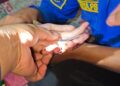 Hitungan menit Damkarmat Lamsel,  “Gercep” Bantu warga evakuasi cincin dijari