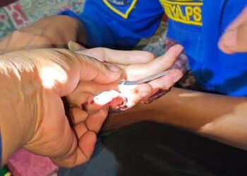 Hitungan menit Damkarmat Lamsel,  “Gercep” Bantu warga evakuasi cincin dijari
