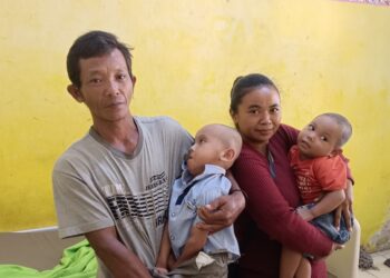 Dua Balita Di Lampura Menderita Gizi Buruk, Orang Tua Ga Mampu Beli Susu