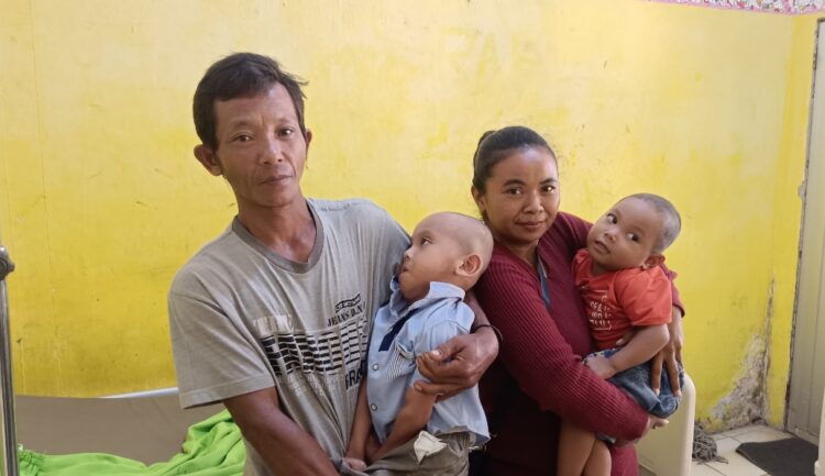 Dua Balita Di Lampura Menderita Gizi Buruk, Orang Tua Ga Mampu Beli Susu