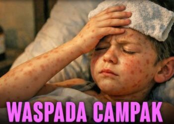 Waspada, Ancaman Penyakit Campak Di Lampura